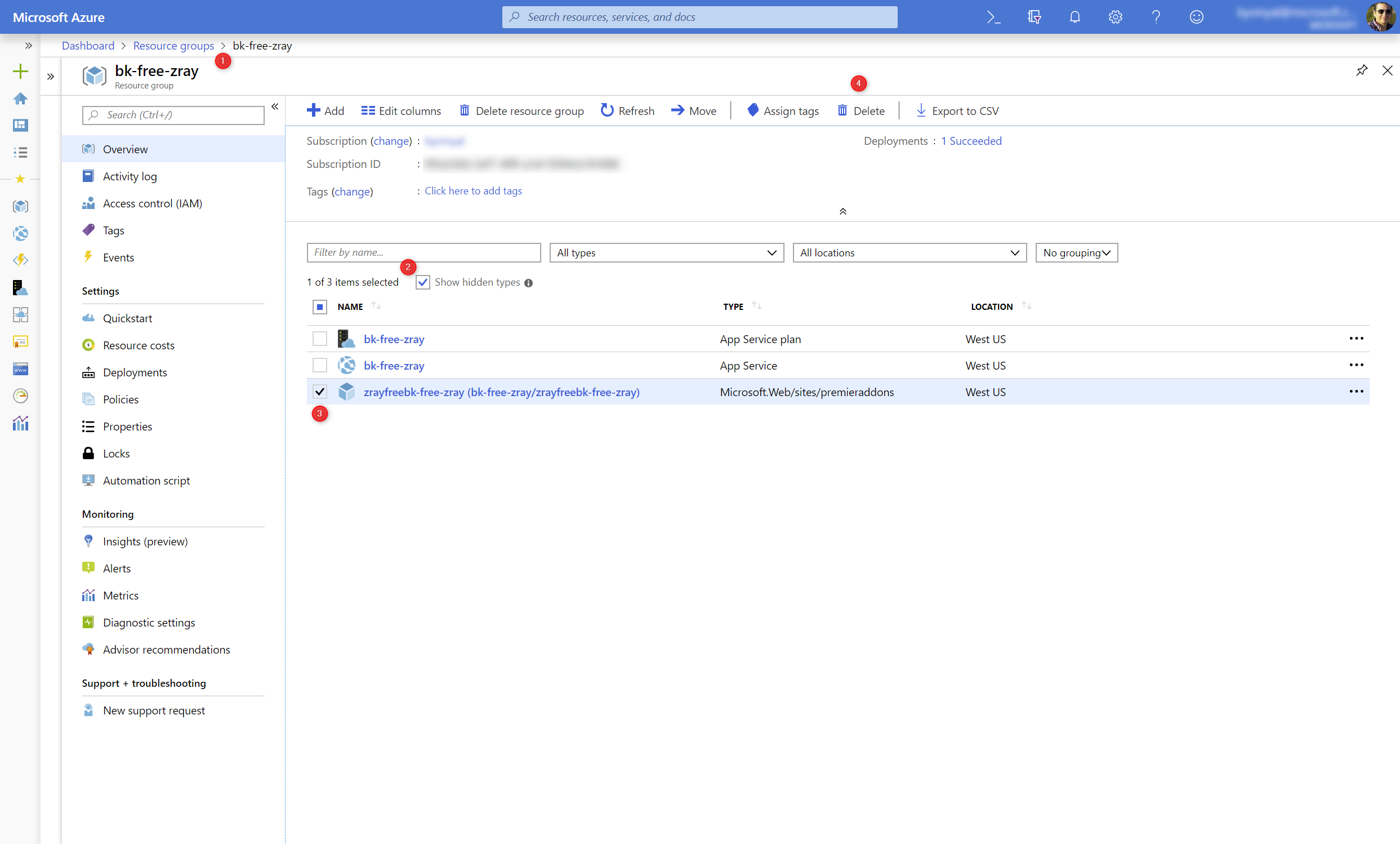 Delete Z-Ray Delete Z-Ray